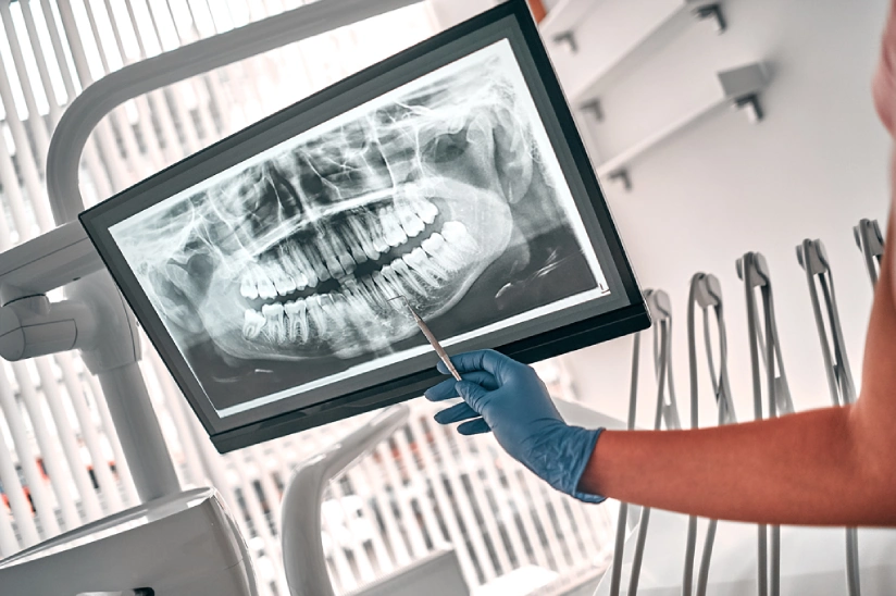 dental-implants-step2